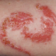 Illustration for article titled Why you should avoid ‘black henna' tattoos